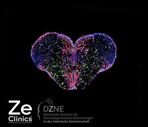 ZeClinics DZNE Agreement